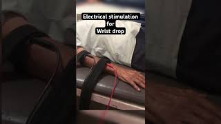 Electrical stimulation for wrist drop shorts physiotherapy [upl. by Elok]