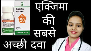 Graphitis pentarkan for eczema  Graphites pentarkan reviews in hindi [upl. by Lionello]