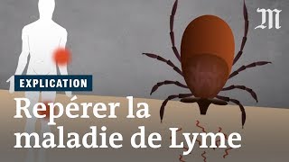 Maladie de Lyme  comment la repérer [upl. by Neevan17]