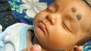 बच्चों के लार टपकने के कारण और इसे रोकने के उपाय Causes Of Drooling In Children And Ways To Stop It [upl. by Amund]