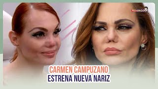 Carmen Campuzano se vuelve a hacer otra operación  MICHISMECITO [upl. by Elsinore]