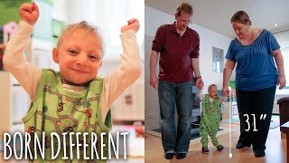 Tiny 31Inch Boy With Primordial Dwarfism Defies Doctors  BORN DIFFERENT [upl. by Yolande]