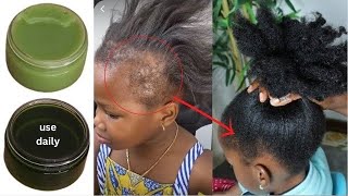 VISIBLE RESULTS IN DAYS MOST POTENT HERBAL HAIR GROWTH CREAM 😱 USE DAILY FOR EXTREMELY HAIR GROWTH [upl. by Ammann]