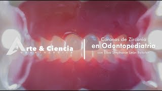 ►Coronas de Zirconia en Odontopediatría  Dra Stephanie León [upl. by Epolulot]