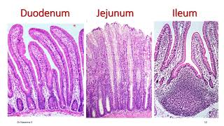 Jejunum and ileum  Differences  med tutorials [upl. by Stoeber]