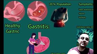 Understanding Gastritis Causes Symptoms and Treatments [upl. by Eenet955]