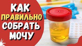 Как правильно собрать мочу для общего анализа общийанализмочи анализмочи оам [upl. by Sihunn]