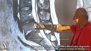 RTG MRI štrukturálna a diferenciálna diagnostika 2 MUDr Richard Smíšek SPS metóda SMSystém [upl. by Nisay]