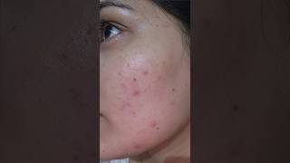 I tried viral Indulgeo Heads Off Serum amp This Happened 😳 shorts ytviral ytshortsindia [upl. by Notsgnik]