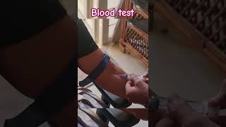 Blood test💉🩸 bloodtest viral trending trend shortsfeed shorts shortsvideo [upl. by Braasch]