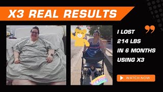 Woman Loses 214 lbs with X3 Bar In Just 6 Months [upl. by Glennis]