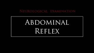 Abdominal reflex [upl. by Elocn2]