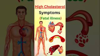 STOP Ignoring These Warning Signs of High Cholesterol [upl. by Hachmin]