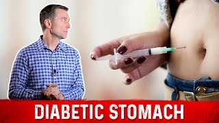 Diabetic Stomach Explained – Dr Berg [upl. by Ashwin601]