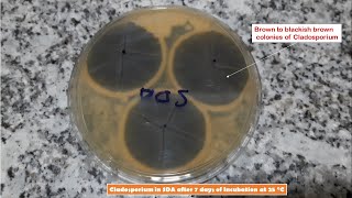 Cladosporium and Penicillium Colony Morphology on SDA and LPCB Preparation [upl. by Lyred]