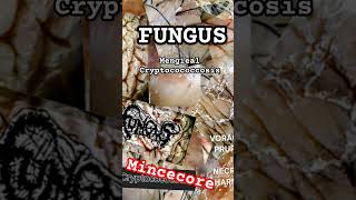 mincecore FUNGUS  MENGIEAL CRYPTOCOCCOSIS mincecore mincecore grindcore crustpunk fungus [upl. by Hayne]