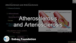 Atherosclerosis and Arteriosclerosis Biology Lecture  Sabaqpk [upl. by Inigo]