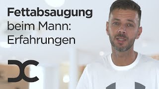 Fettabsaugung beim Mann  Erfahrungsbericht  Dorow Clinic [upl. by Slade]