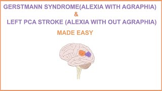 GERSTMANN SYNDROMEALEXIA WITH AGRAPHIA amp LEFT PCA STROKEALEXIA WITHOUT AGRAPHIA MADE EASY [upl. by Cheryl]