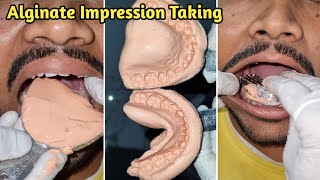 Alginate Impression Taking  Dental Impression  Alginate Impression [upl. by Merat]