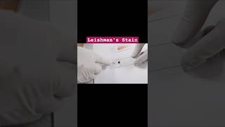 Blood smear preparationperipheral blood smear  blood smear leishmans stainbloodtestlaboratory [upl. by Oiligriv]