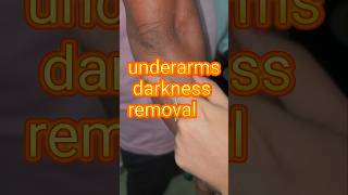 Underarms darkness removal [upl. by Alrrats287]