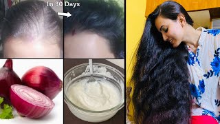 DIY Onion Hair Growth Mask  बालों की DENSITY और VOLUME को DOUBLE करें सिर्फ 30 दिनों में [upl. by Eldwun495]