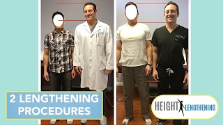 Recovering from a Double Limb Lengthening Procedure  Height Lengthening [upl. by Lucchesi]