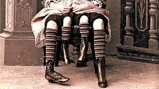 The Story of Myrtle Corbin the Real Life Four Legged Girl [upl. by Avin]