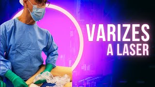 Como é feita a Cirurgia de varizes a Laser cirurgiadevarizes varizesalaser laser [upl. by Anneres]