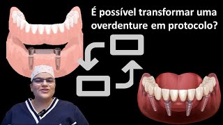 É possível transforma uma overdenture em um protocolo Dra Bianca Rosa  Clínica Bianca Rosa [upl. by Annaitat206]