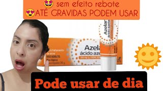 tratamento para melasma AZELAN pode usar de dia [upl. by Olaznog]