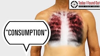 Why Was Tuberculosis Called Consumption [upl. by Paco731]