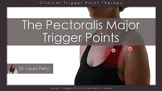 The Pectoralis Major Trigger Points [upl. by Sascha]