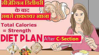 सिजेरियन डिलीवरी के बाद क्या खाये और क्या खाने से बचे  Diet Food After Cesarean Delivery [upl. by Secunda]