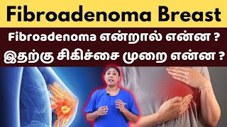 Fibroadenoma Breast  Fibroadenoma என்றால் என்ன  இதற்கு சிகிச்சை முறை என்ன [upl. by Leopoldeen]