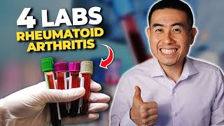 4 Rheumatoid Arthritis LABS that you Need to Know  Rheumatologist Dr Micah Yu [upl. by Rolfe]