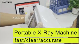 The use of Portable XRay Machine with Sensor  fast clear and accurate [upl. by Oilcareh136]