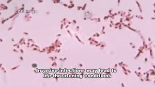 Fusobacterium amp Infections [upl. by Iona]