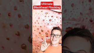 Crazy BLACKHEAD PLUCKING pt2  Painstaking Blackhead Removal shorts [upl. by Fe]