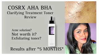 I TRIED THIS TONER FOR 5 MONTHS  MY HONEST REVIEW  IN TAMIL  COSRX AHA BHA TREATMENT TONER [upl. by Paulo]