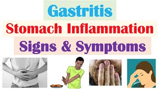 Gastritis Stomach Inflammation Signs amp Symptoms Complications amp Why They Occur [upl. by Ivon]