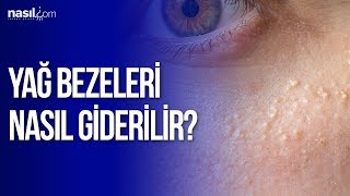 Göz Çevresindeki Yağ Bezeleri Nasıl Giderilir [upl. by Notlrac]