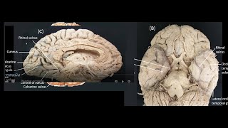 Medial and Inferior views of cerebral cortex [upl. by Notsreik]