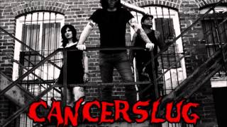 Cancerslug  Generation Behind  seasons of sickness [upl. by Indihar519]