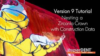 hyperDENT V9 Tutorial Nesting a Zirconia Crown with Construction Data [upl. by Anilos]