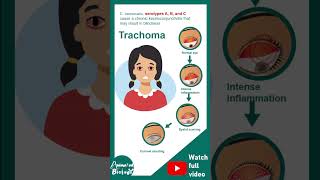 Chlamidiae and its serotypes  Microbio in 1 minute [upl. by Yroc792]