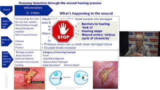 Understanding Wound Dressings Categories and Indications [upl. by Goodard]