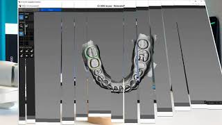 CS 3600 Access Intraoral Scanner  Streamhealth Dental [upl. by Pazit815]