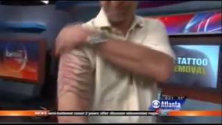 Worst Tattoos  Laser Tattoo Removal Contest in Atlanta  CBS 46 Better Mornings Atlanta [upl. by Harac]